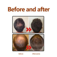 Loción de raíz de hierbas que fija la línea densa, repara, endurece, hidrata y previene la caída del cabello - details 9