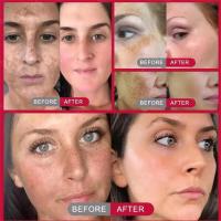 Suero Blanqueador Corrector de Manchas Dark Spots Iluminador de Piel Cuidado de Belleza Coreano - details 0