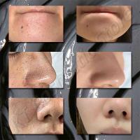 Mascarilla de Lodo Volcánico Limpieza Profunda de Poros, Control de Aceite, Hidratación, Iluminación de Piel Suave Herramientas de Cuidado de la Piel Facial - details 4