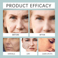 La esencia de retinol WIYUN puede suavizar e hidratar, mejorar la piel seca y nutrir la piel del rostro. - details 11