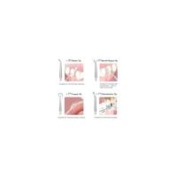 Irrigador bucal portátil,Irrigador bucal profesional Limpiador de hilo dental más saludable Limpiador más blanco verde - details 1