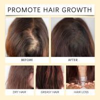 HOEGOA Extracto de planta esencial para el cuidado, suave, brillante, no graso, reparación suave, aceite nutritivo para el brillo del cuero cabelludo y el cabello - details 8