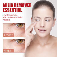 Ácido hialurónico suero para ojos removedor de partículas de grasa ácido hialurónico cuidado de la piel bolsas para ojos crema hidratante ojeras cuidado coreano - details 6