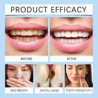 Care Spray cuida la higiene dental, reduce las manchas, mantiene los dientes naturalmente limpios, frescos y brillantes. - details 8