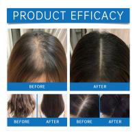 El masaje con aceite nutritivo para el cuero cabelludo HOEGOA calma, fortalece el cabello, mejora la sequedad, la suavidad y el brillo. - details 10