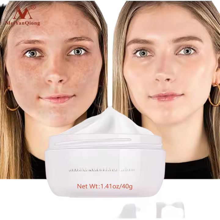 Crema Facial Hidratante Tratamiento de Acné Elimina Manchas Dark Ilumina Piel Reafirma Piel - 1