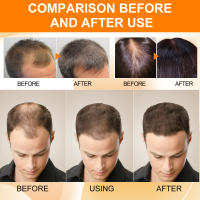 El aceite esencial de cuidado hidrata, suaviza, seca y nutre profundamente el cabello sin enredos - details 8