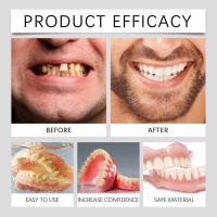 Las prótesis dentales decorativas mejoran la belleza de las sonrisas con materiales cómodos, permitiendo una sonrisa natural. - details 11