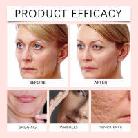 La crema hidratante de colágeno hidrata y mejora la piel facial opaca, haciendo que sea firme y translúcida. - details 11
