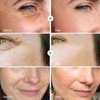 Retinol-Juego de suero Facial eliminador de arrugas, crema antienvejecimiento reafirmante instantánea, blanqueamiento de líneas finas, cuidado hidratante de la piel - details 0