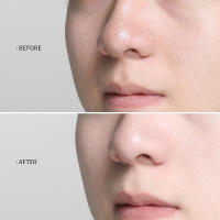 Crema de suero facial de Ácido Kójico, Corrector de manchas oscuras, blanqueamiento hidratante, esencia de niacinamida, reafirmante, cuidado de la piel, Corea - details 4