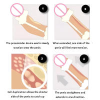 Kit de Extensor de Penis Ajustable Dispositivo de Extensión Masculina Portátil Efectivo con Certificado CE - details 5