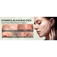 blackhead problem