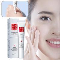 Crema Blanqueadora Anti-Manchas, Melasma, Acné Herramienta de Cuidado de la Piel para Iluminar - details 2