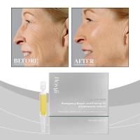 Suero de emergencia de un solo uso, suero Facial hidratante e iluminador, 1,2 ml/30 Uds. - details 4
