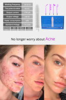 Máquina Facial de alta frecuencia, herramientas para el acné, masajeador Facial, cuidado de la piel, Spa de belleza para el cabello - details 1