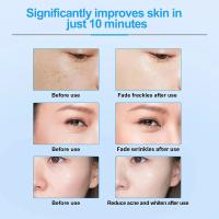 EMS-máquina de estiramiento de la piel Facial, terapia de calor por radiofrecuencia, moldeador corporal, instrumento de masaje ocular - details 12