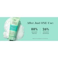 acne patches self care blackhead toner skincare pore minimizer