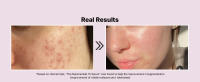 COSRX Niacinamide 15% Face Serum, Minimize Enlarged Pores, Redness Relief, Discoloration Correcting