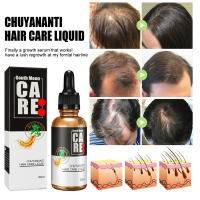 Aceite esencial de South Moon, esencia para el cuero cabelludo, cuidado del cabello, líquido de masaje nutritivo - details 5