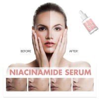 Sérum Facial Coreano Niacinamida Ilumina la Piel, Rejuvenece, Hidrata, Blanquea, Desvanece Manchas y Líneas Finas Herramienta de Cuidado de la Piel de Belleza - details 16