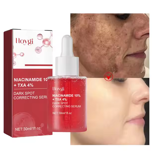 Esencia Corrector Dark 10% Niacinamida+ 4% Tranexámica Para Marcas de Acné y Hiperpigmentación - 1