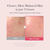 Medicube TXA+Niacinamide 15% Sérum facial brillante para el cuidado de las manchas - details 1
