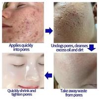 Crema Reductora de Poros de Ácido Salicílico Adiós a los Pulgares, Reparación de Piel, Estiramiento - details 12