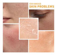 Conjunto de Cuidado de la Piel de Vitamina C de 6 Piezas Incluye Toner, Sérum, Crema para los Ojos, Crema Facial, Protector Solar, Limpiador de Piel Húmedo - details 2