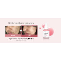 pdrn, glow serum, pink glow serum, vegan pdrn, dark spots, fine lines