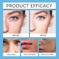 Crema facial súper brillante, suave, ligera que retiene agua, no grasa, seca e hidratante - details 11