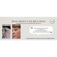 rice MASK