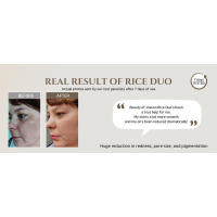 Tónico facial de arroz reabastecedor de brillo Beauty of Joseon para piel mixta grasa, cuidado coreano hidratante y equilibrante 150ml - details 3