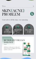 Loción para el acné del árbol del té, cuidado facial antiacné, crema hidratante de día y de noche para mujeres y hombres - details 2