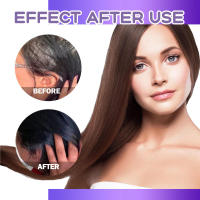 Las gotas de folículos reparan los folículos, nutren las raíces y cuidan el cabello grueso y firme - details 5