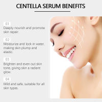 Esencia Facial de Centella Asiatica, suero Facial hidratante que ilumina el cuidado de la piel suave, rejuvenecimiento, refinamiento de poros, rejuvenecimiento - details 7