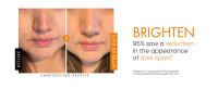 vitamina c para la cara mujer best vitamin c serum for face vitamin c for skin c serum for face
