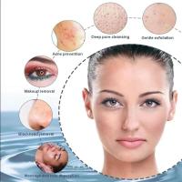 Cepillo de limpieza sónico impermeable, limpieza de poros faciales y exfoliante, limpieza eléctrica de silicona portátil 6 en 1 - details 9