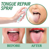 Reparación de revestimiento, blanqueamiento, alivia la lengua seca, hinchazón, cuidado bucal, aerosol - details 8