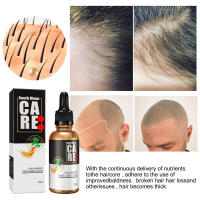 Aceite esencial de South Moon, esencia para el cuero cabelludo, cuidado del cabello, líquido de masaje nutritivo - details 2