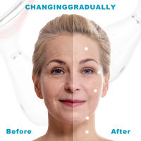 Terapia de luz roja para cara y cuello, Varita Facial ondulada, belleza elegante, dispositivo Facial multifuncional, plateado - details 4