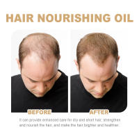 La loción para el cabello densa con aceite de nuez marroquí de Eelhoe previene la caída del cabello, solidifica, suaviza el cabello, nutre, masajea el cuero cabelludo y - details 7