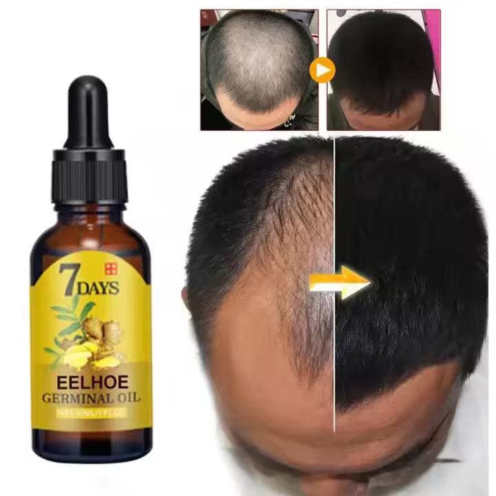 Serum de Crecimiento de Cabello Aceite Esencial de Jengibre para Regeneración Rápida - 1