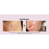 Suero facial con niacinamida COSRX 15% minimizador de poros, tono uniforme, cuidado de la piel coreano - details 1