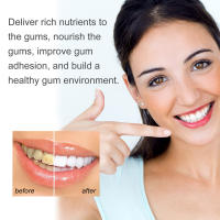 Pluma de Líquido de Reparación de Chicle Elimina Manchas Dentales, Blanquea Dientes, Cuida Encías, Cuidado Oral, Belleza - details 5