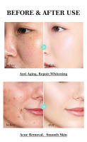 Crema antiarrugas para la cara efecto instantáneo eliminación de arrugas crema facial antienvejecimiento mejora las líneas finas cuidado nutritivo de la piel 30g - details 12
