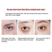 Crema para ojos con retinol antiarrugas, cuidado de la piel para los ojos, elimina las ojeras y las bolsas - details 4