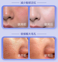 Máscara facial de rejuvenecimiento de la piel con fotones, dispositivo de belleza con espectro de siete colores - details 3