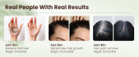Batana Oil for Hair Growth
