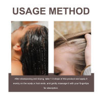 Mejora la sequedad, fortalece, nutre el cuero cabelludo y el cabello, aceite esencial para el cuidado del cabello. - details 3
